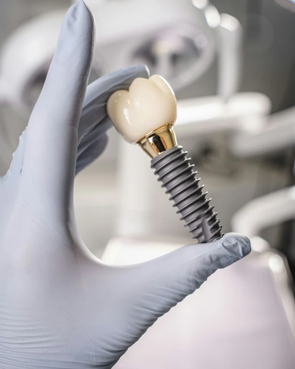 Eine behandschuhte Hand hält ein Implantat mit Krone